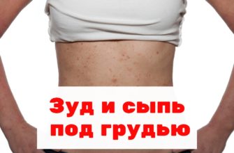 Сыпь под грудью