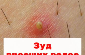 Зуд вросших волос