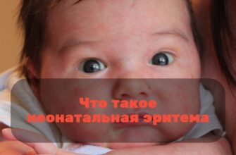 Что такое неонатальная эритема