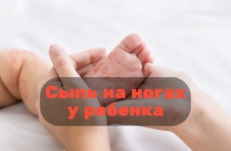 Сыпь на ногах у ребенка