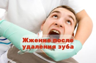 Жжение после удаления зуба