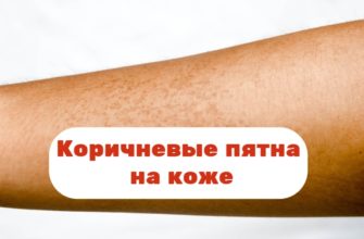 Коричневые пятна на коже