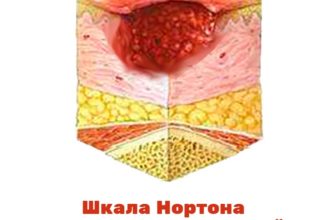 Шкала Нортона