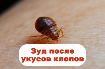 Зуд после укусов клопов